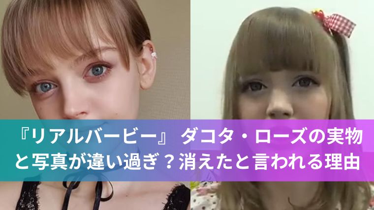 『リアルバービー』 ダコタ・ローズの実物と写真が違い過ぎ?消えたと言われる理由も