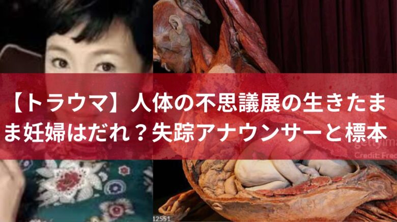 【トラウマ】人体の不思議展の生きたまま妊婦はだれ？失踪アナウンサーと標本